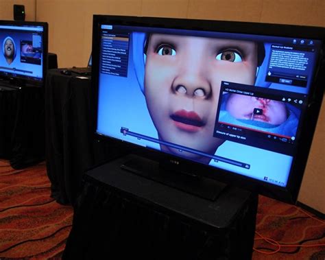 smile telesync|Cleft Care Technology .